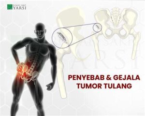 featured_image