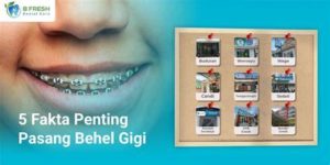 featured_image