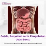 featured_image