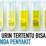 featured_image
