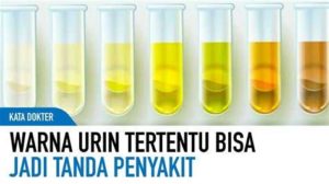 featured_image