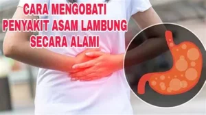 Cara Mengatasi Asam Lambung Naik Secara Alami