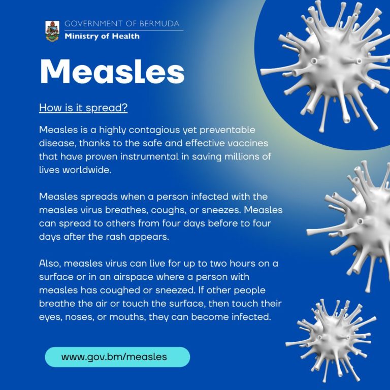 Measles Menular Sebelum Gejala Muncul: PAPDI Tekan Pentingnya Vaksinasi Dewasa untuk Hentikan Wabah