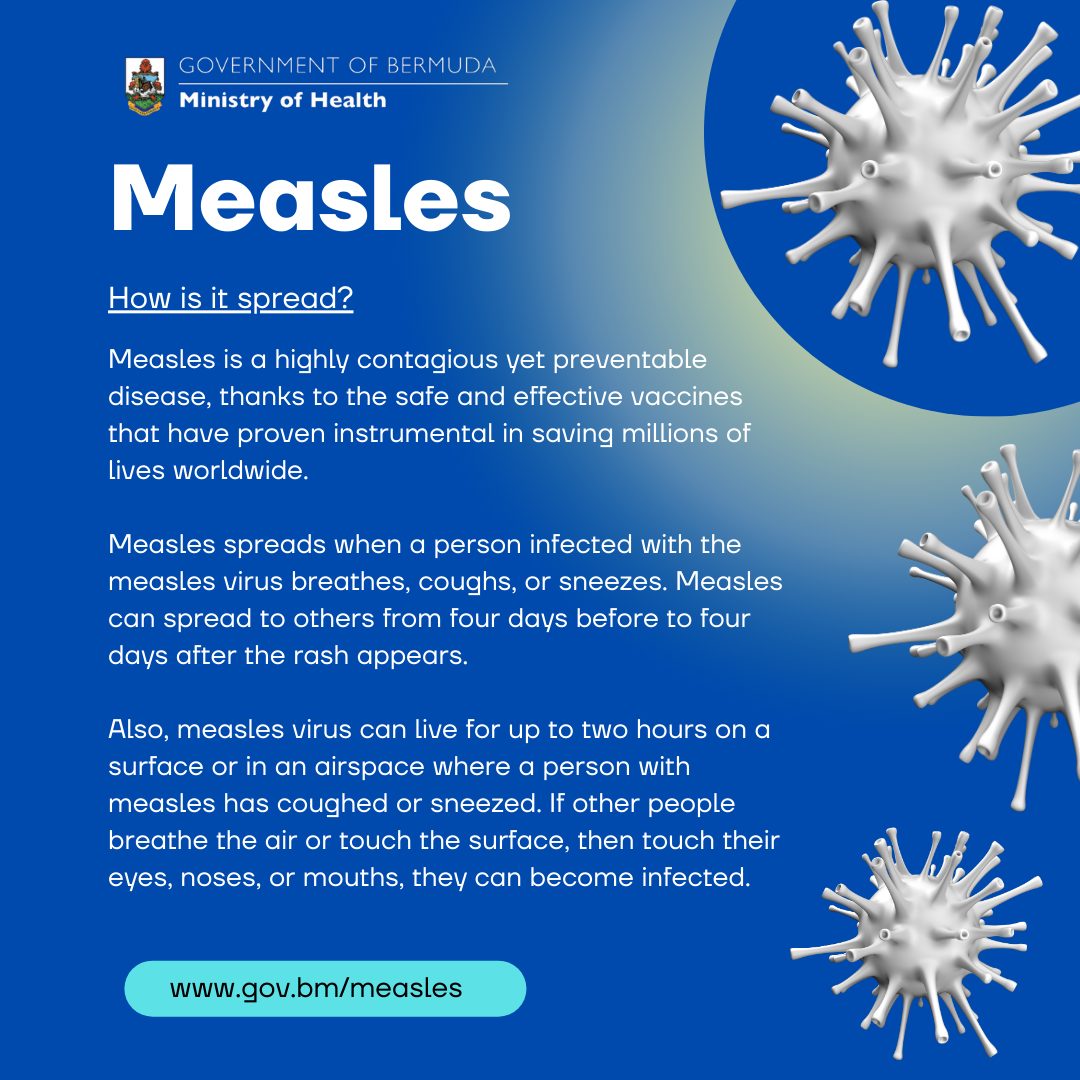 Measles Menular Sebelum Gejala Muncul: PAPDI Tekan Pentingnya Vaksinasi Dewasa untuk Hentikan Wabah