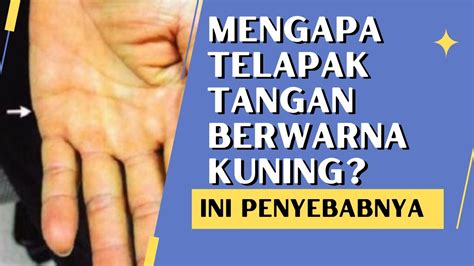 featured_image