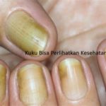 featured_image
