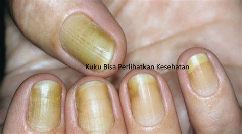 featured_image