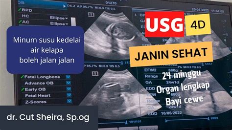 featured_image