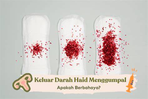 featured_image