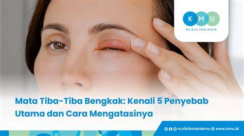 featured_image