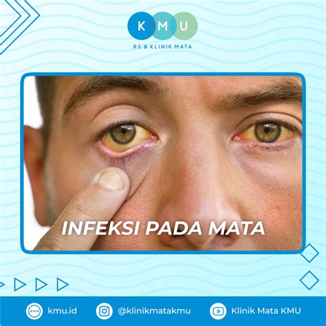 featured_image