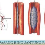 featured_image