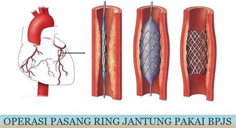 featured_image