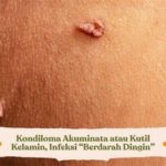 featured_image