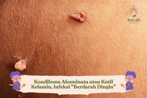featured_image