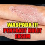 featured_image
