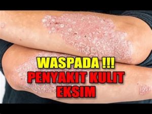 featured_image