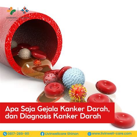 featured_image
