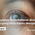 featured_image