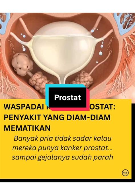 featured_image