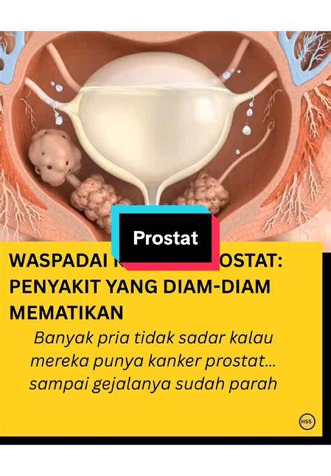 featured_image